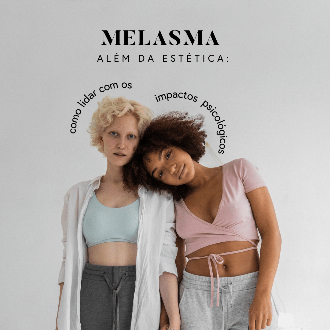 Melasma alem da estética