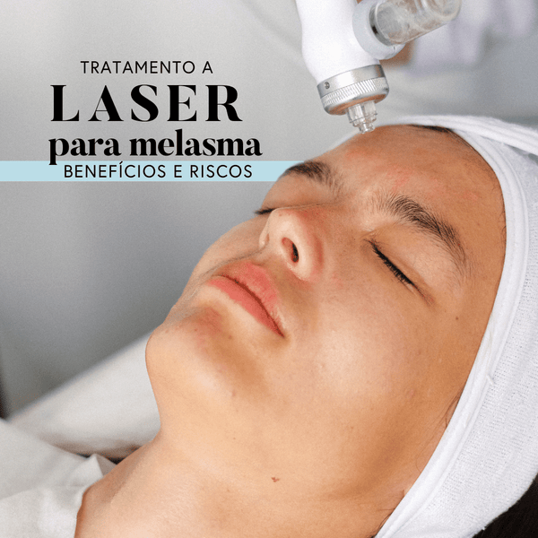 tratamento a laser para melasma