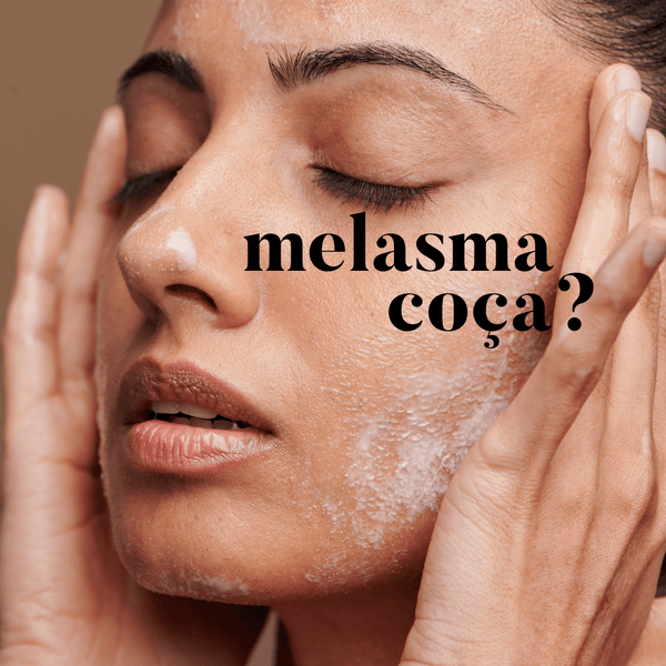 melasma coça