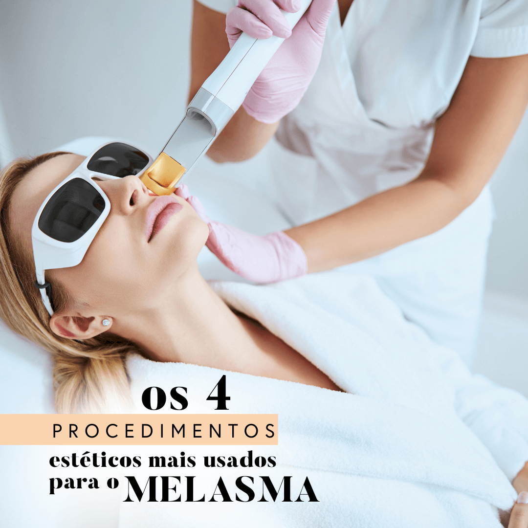 procedimentos estéticos mais usados para o melasma