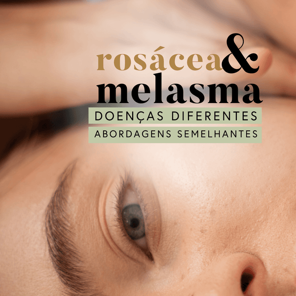 Melasma ou Rosacea