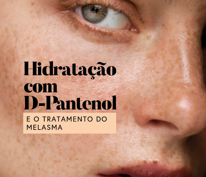 A importância da hidratação com D-Pantenol durante o tratamento do melasma