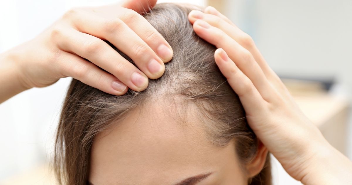 Queda de cabelo feminino