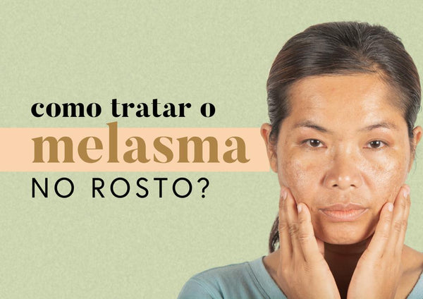 Como tratar o melasma no rosto?