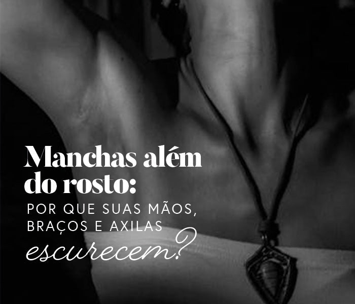 Manchas além do rosto: Por que suas mãos, braços e axilas escurecem?