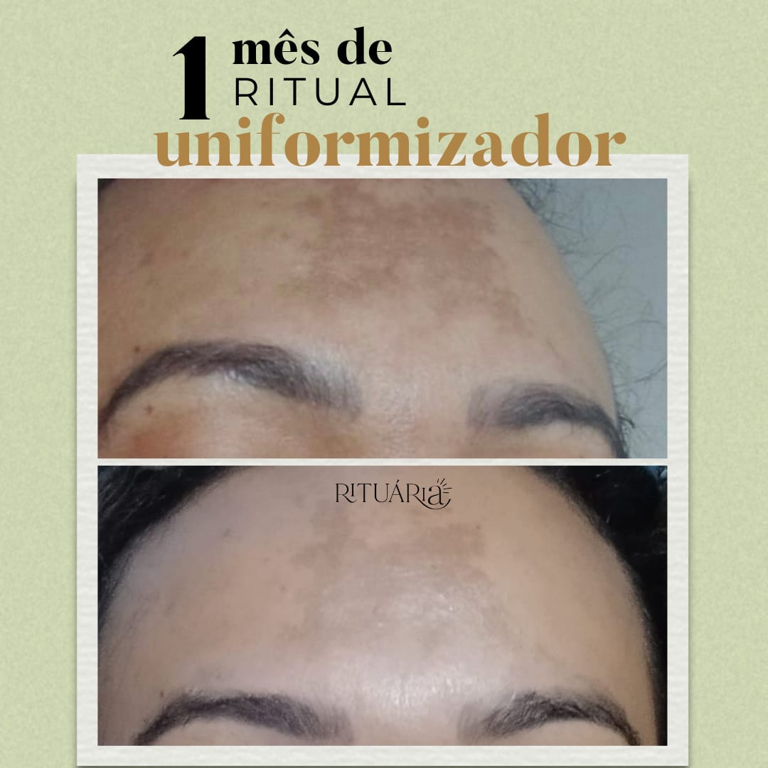 3 Fórmulas Uniformizadoras