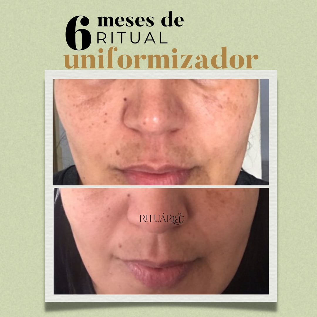 2x Fórmulas Uniformizadoras