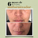 2x Fórmulas Uniformizadoras