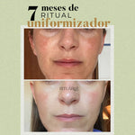 2x Fórmulas Uniformizadoras