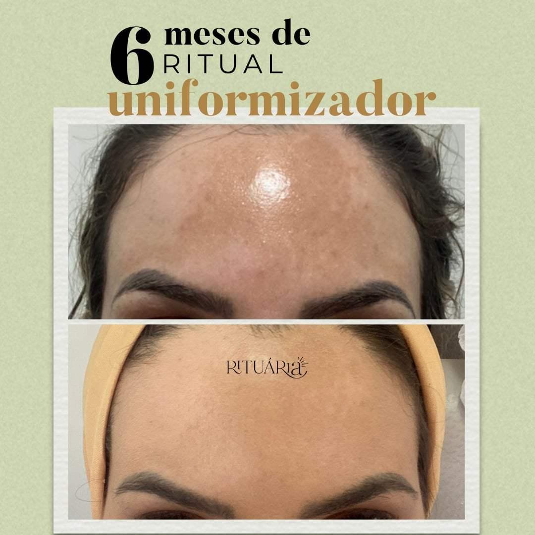 Brinde Surpresa 4