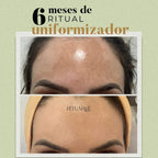 2x Fórmulas Uniformizadoras