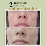 2x Fórmulas Uniformizadoras