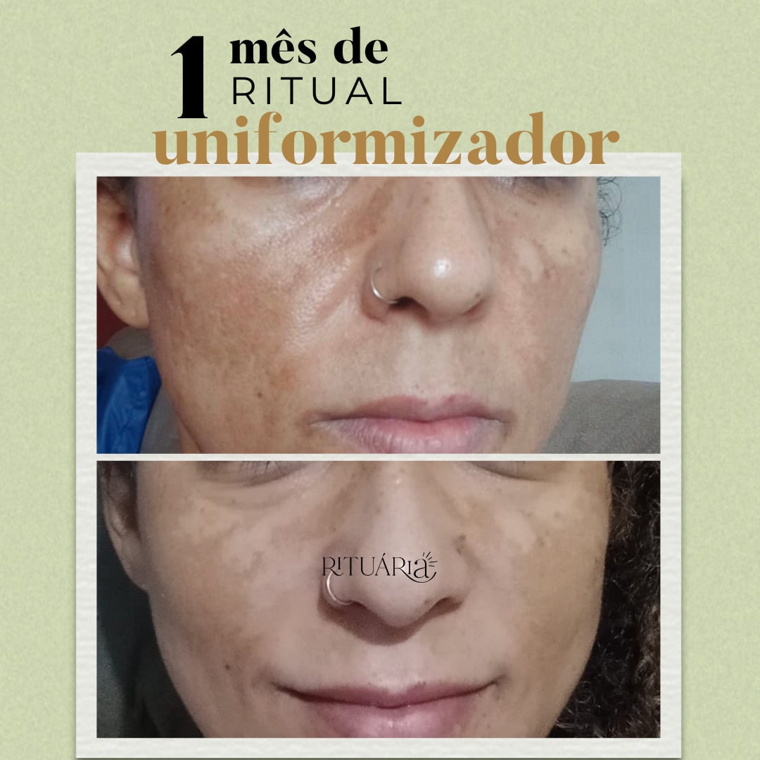 2x Fórmulas Uniformizadoras