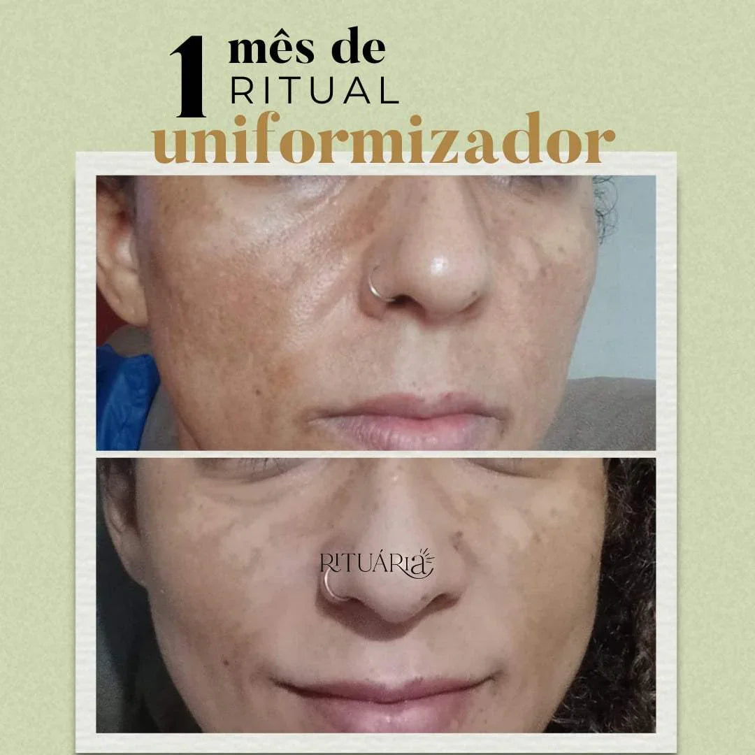 2x Fórmulas Uniformizadoras