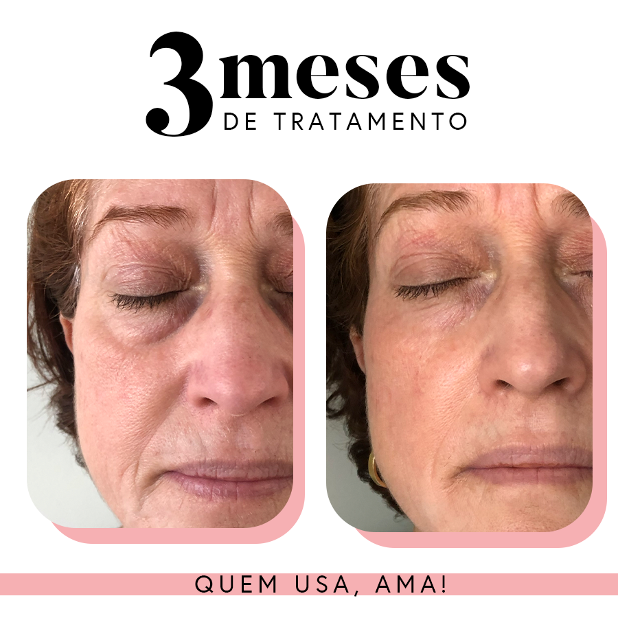 Ritual Essencial para Manchas e Linhas Finas (Uniformizadora + Renovadora)