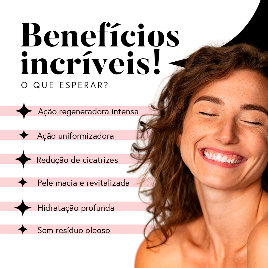 Óleo de Rosa Mosqueta 30ml - 100% Puro