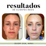 Ritual Essencial para Manchas e Melasma