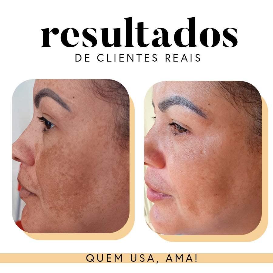 Fórmula Antioxi Nutri – Protetor Solar Oral (90 cápsulas – 3 meses)