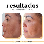 Fórmula Antioxi Nutri – Protetor Solar Oral (90 cápsulas – 3 meses)