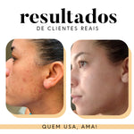 Fórmula Antioxi Nutri – Protetor Solar Oral (90 cápsulas – 3 meses)