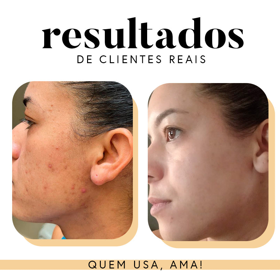 Fórmula Antioxi Nutri – Protetor Solar Oral (90 cápsulas – 3 meses)