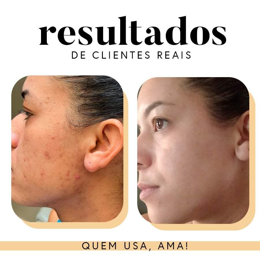 Fórmula Antioxi Nutri – Protetor Solar Oral (90 cápsulas – 3 meses)