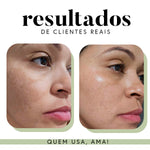 Ritual Essencial para Manchas e Melasma