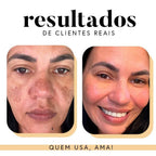Fórmula Antioxi Nutri – Protetor Solar Oral (90 cápsulas – 3 meses)