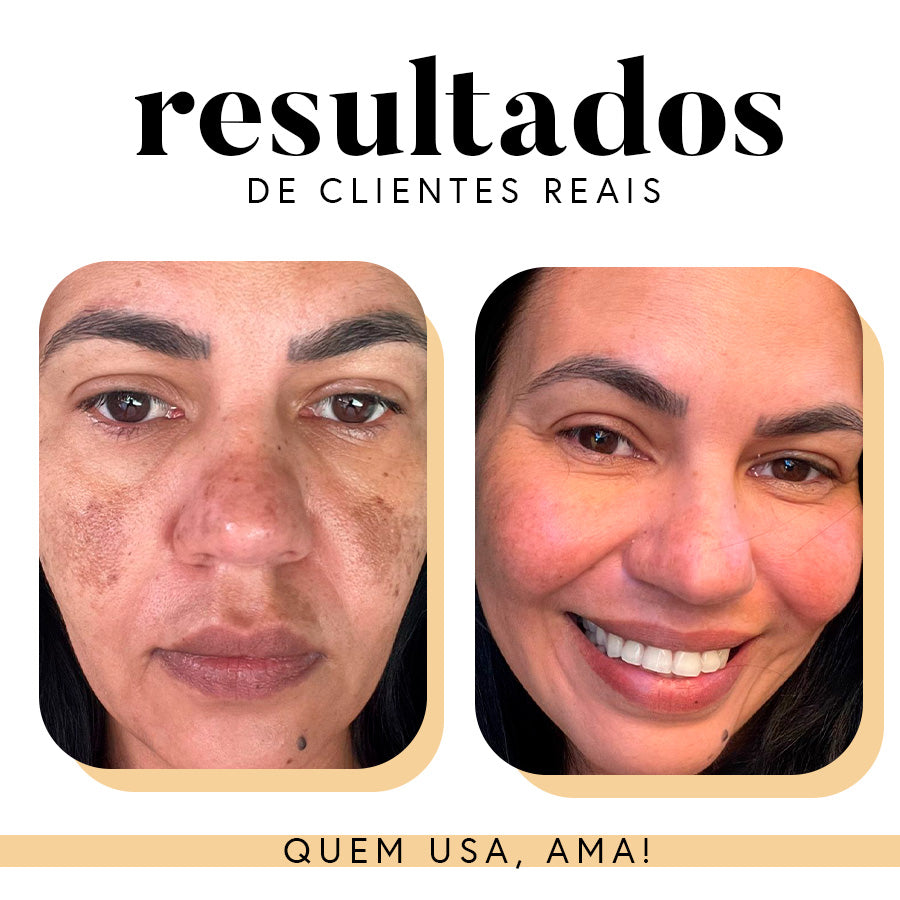 Fórmula Antioxi Nutri – Protetor Solar Oral (90 cápsulas – 3 meses)